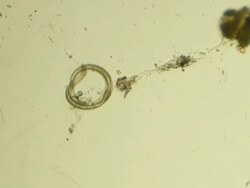 Microscopic worm Stock Footage