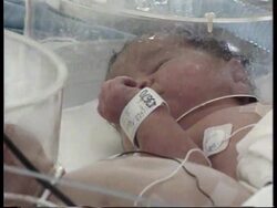 Israel - Siamese Twins News Clip