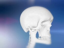 HD: Human Skull Indicating A Headache Stock Footage