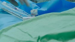 Operating room. Doctor takes pulsometer Stock Footage