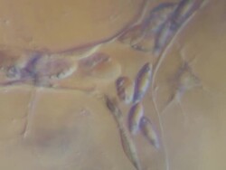 Blood cells moving slowly through capillaries of tail of tadpole of Toad Bufo bufo Stock Footage