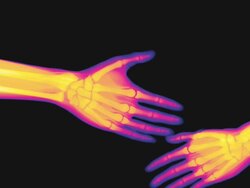 Fast X-ray handshake Stock Footage