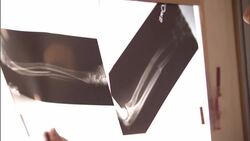 ECU, PAN, Male doctor examining x-ray Stock Footage