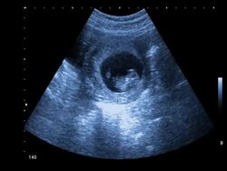 First move Stock Footage