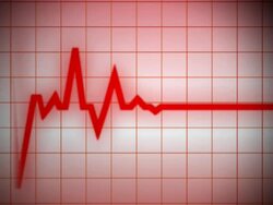 Heart Monitor EKG with Shape Stock Footage