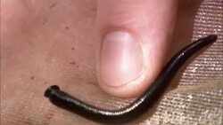 A finger pokes at a leech as it crawls across skin. Stock Footage