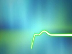 Heartbeat / Pulse Loop Stock Footage