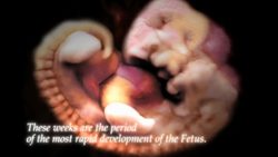 Alexander Tsiaras: Conception to birth -- visualized Instructional Video