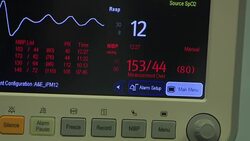 Stock Shots Vital Signs Monitor News Clip