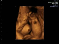 Baby Scan Stock Footage