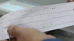ECG Stock Footage