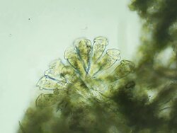 Microorganisms, groupe of vorticelas Stock Footage