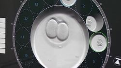 VOICED : Medico ucraniano pionero en concepcion de bebes con tres padres News Clip