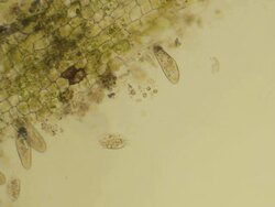 Micro organisms eating particle of plant Stock Footage