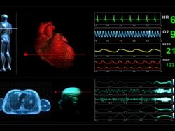 Medical Scanner Monitor Display X-Ray Stock Footage