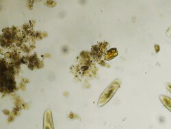 Groupe of Paramecium Caudatums Stock Footage