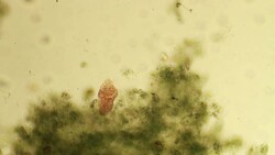 Microorganism - ciliate Stock Footage