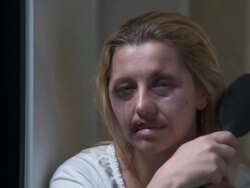 HD DOLLY: Abused Wife With Hope Stock Footage