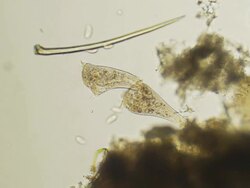 Microorganism - Stentor Stock Footage