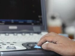 Ultrasound Stock Footage