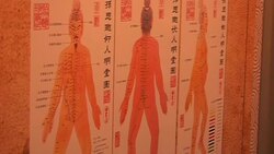 Acupuncture Used as Weapon to Fight Opioids Instructional Video