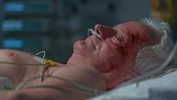 Senior man lying in ICU after surgery with eyes opened Stock Footage