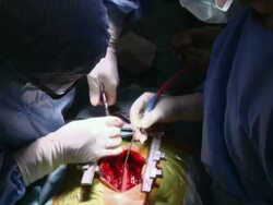 MS TD Doctors operating on woman / Cagliari, Sardinia, Italy Stock Footage
