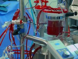 Doctor near Cardiopulmonary bypass machine Stock Footage
