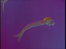 Microscopic, tracking across cercarial stage Schistosoma mansoni, interference contrast illumination Stock Footage