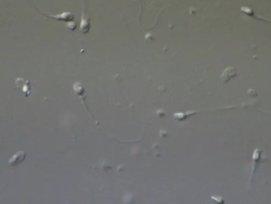 Human sperm swimming, Interference contrast Stock Footage