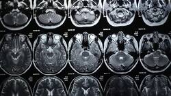 MRI Film Stock Footage