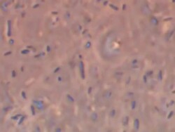 Mixed bacterial sample taken from decaying chicken, should contain Salmonella typhimureum. Phase Contrast illumination. Stock Footage