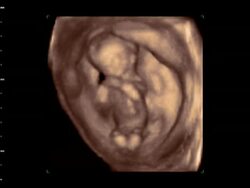 Young foetus moving in the womb, 4D ultrasound scan.. Stock Footage