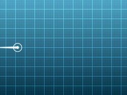 Heart Monitor Stock Footage