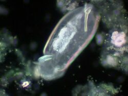 Rotifer feeding Stock Footage