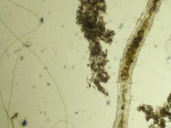 Microscopic worm crawls Stock Footage