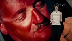 Boddities | Episode 10 | What  happens when skin gets sunburned? Instructional Video