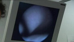 Pioneering surgery for unborn babies News Clip