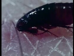 Flea feeding on human skin, archive, CU Stock Footage