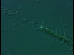 CU microscopic view of bacteria and algae from farmyard pool Stock Footage