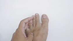Nail foot off. Stock Footage