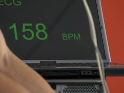 HD:Athlete Performing ECG and VO2 test on Bicycle Stock Footage