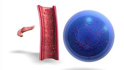 Artificial pancreas: how it works Instructional Video