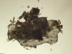 Groupe of Paramecium Caudatums Stock Footage