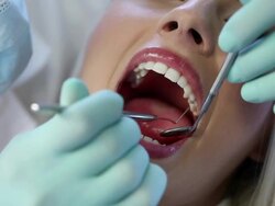 Dentist examining a female patient Stock Footage