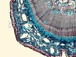 Pine Stem tissue under microscope Stock Footage