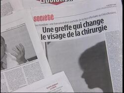 Exteriors hospital, medical expert, headlines News Clip