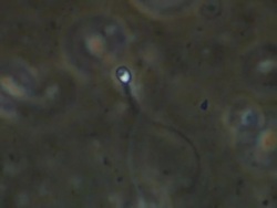 Single Human sperm swimming frenetically, Phase contrast Stock Footage