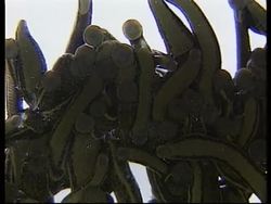 USA: DOCTORS STILL RELYING ON LEECHES News Clip