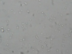 sperm under microscope 400x Stock Footage